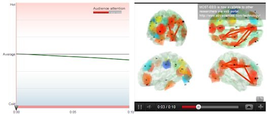 Video Link: MOST-EEG brain function model